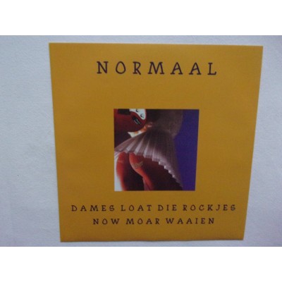 Normaal - Dames loat die rockjes now moar waaien